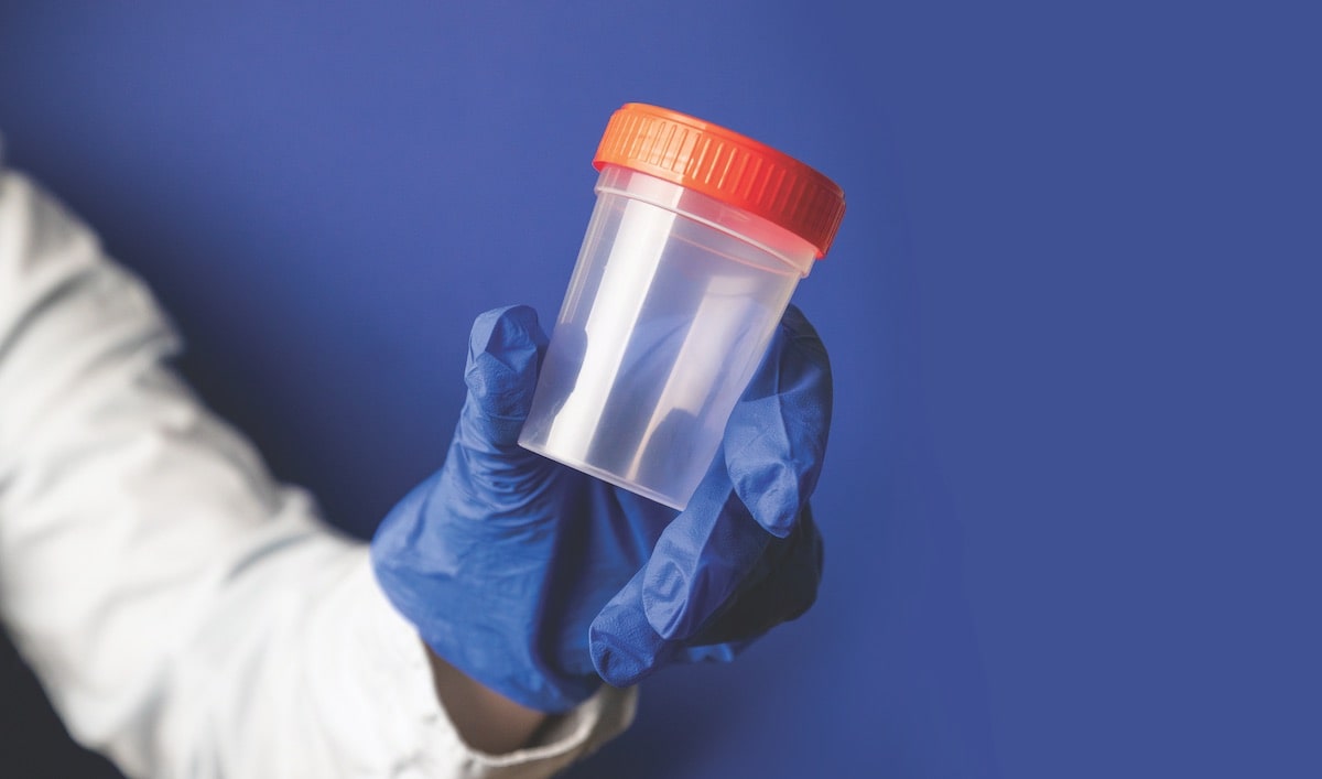 Gloved hand holding urine sample cap for marijuana testing